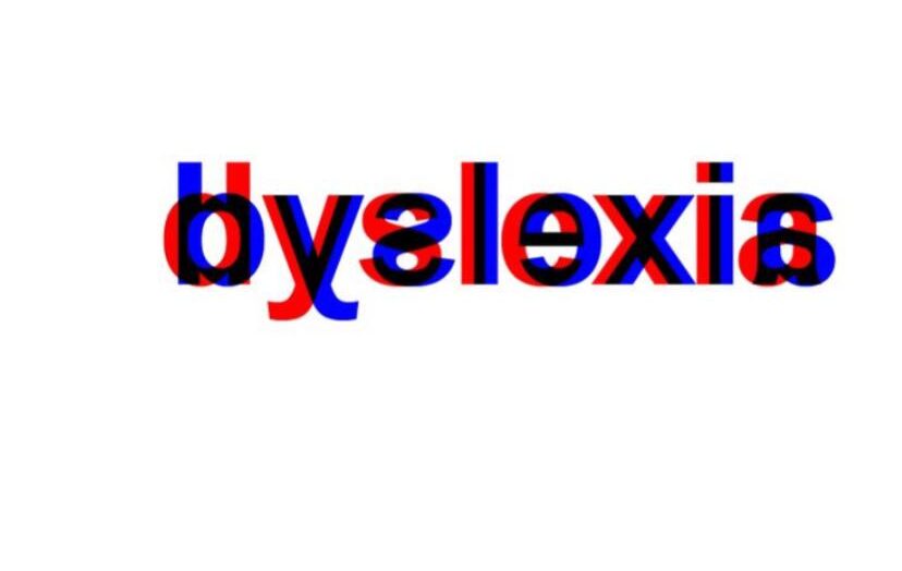 Living with Dyslexia: A Guide to Navigating Daily Life.